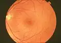 A normal human fundus