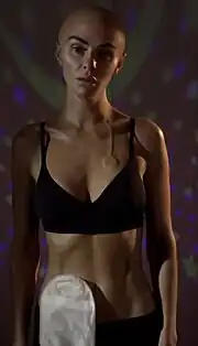 A woman with a shaved head, scars and a stoma looks at the mirror.