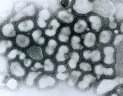 Transmission electron micrograph of influenza A viruses (light objects on a dark background).