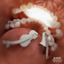 An image of the inside of a mouth with a white violin on the tongue.