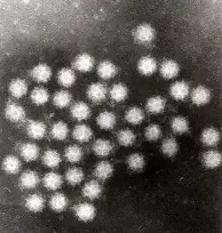 Transmission electron micrograph of Sapporo viruses
