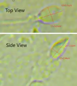 Dimensions of the human sperm head measured from a 39-year-old healthy subject.