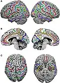 Different views of the sulci of the brain[23]