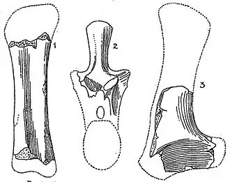 Кости бедра, позвонок и лопатка