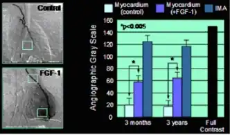 ангиогенез у человека
