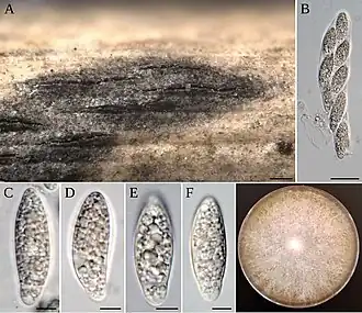На фото: A. balearicum: A — стромы на носителе; B — аски; C–F — аскоспоры; G — колония на MEA. Шкалы: 200 µm (A); 20 µm (B); 5 µm (C–F)