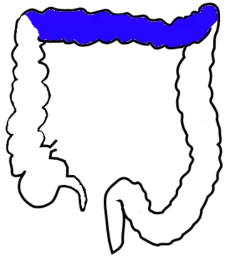 Поперечная ободочная кишка обозначена синим