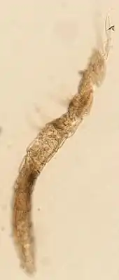 Eosentomon vermiforme