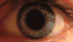 Зрачок человека