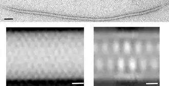 Вирионы вируса Acidianus filamentous virus 3 (AFV3), входящего в реалм Adnaviria