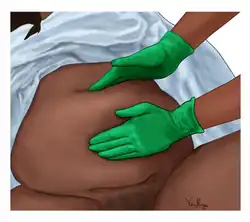 Проведение массажа матки