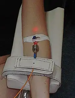An intravenous blood irradiation therapy in use