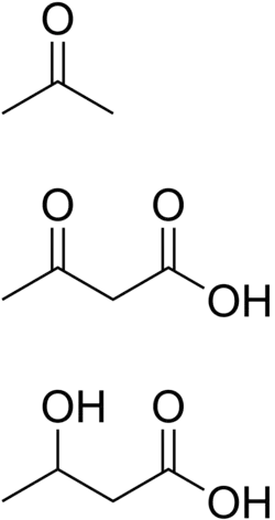 Химическая структура трёх кетоновых тел: ацетон, ацетоуксусная, и бета-оксимасляная кислоты