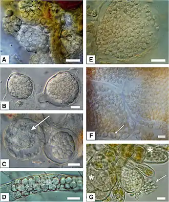 Микрофотографии покоящихся спор Plasmodiophorida и Phagomyxida