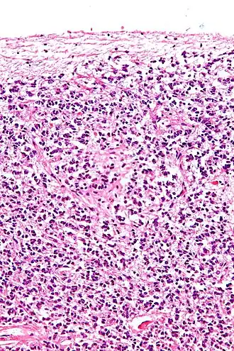 Поперечный разрез шишковидной железы, на котором видны пинеалоциты и другие клетки.