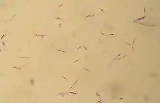 Промастиготы Leishmania tropica. Окраска по Гимзе, 10×100