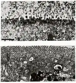 Микрофотография наверху изображает заражённую клетку с разрушенной мембраной, внизу — здоровую клетку.