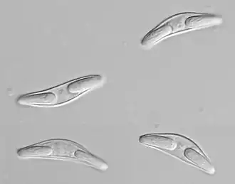 Спора Sphaeromyxa hellandi