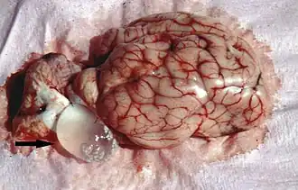 Мозг овцы, поражённый ценурозом