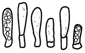 Аски, базальные клетки и аскоспоры гриба