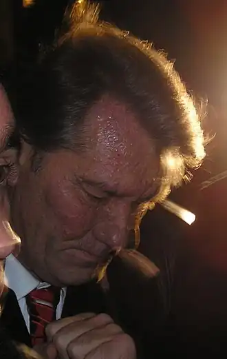 Виктор Ющенко через 1.5 месяца после отравления; октябрь 2004 года